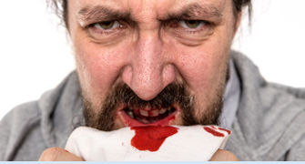 barbat cu sange in batista datorita parodontozei